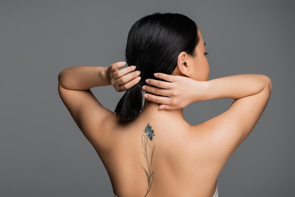 tattoo removal denver